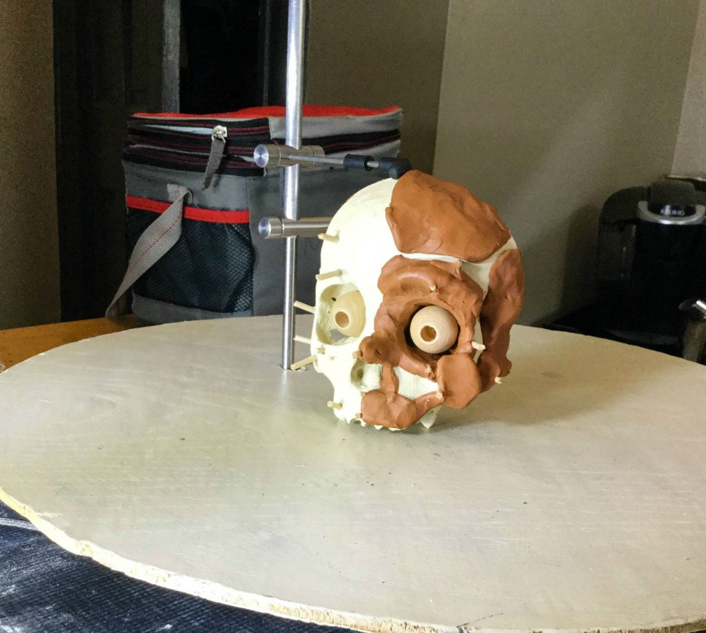 a partial facial skeleton reconstruction produced by 3d printing