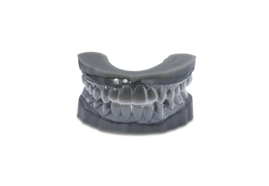 3D printed model of upper and lower teeth