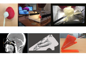 Various uses of 3d printing in medicine