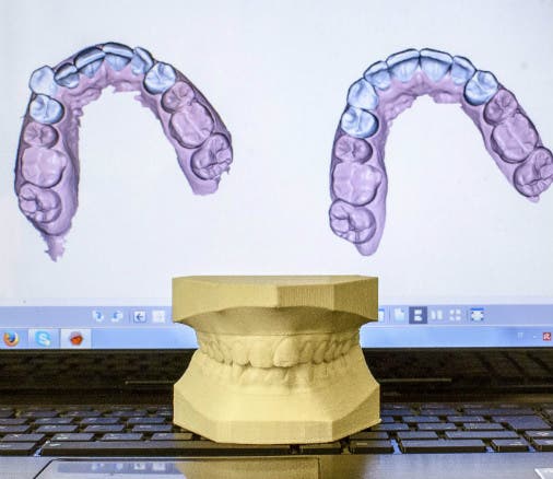 a 3d printed model of a mouth (upper and lower teeth) with the corresponding cad file loaded onto the computer behind it