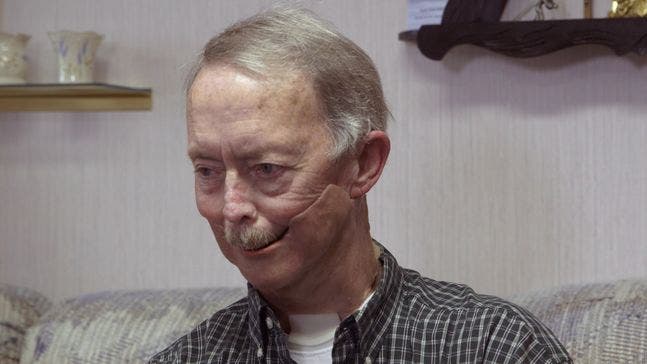 cancer survivor shirley anderson, with a new 3d printed jaw, looking at the camera