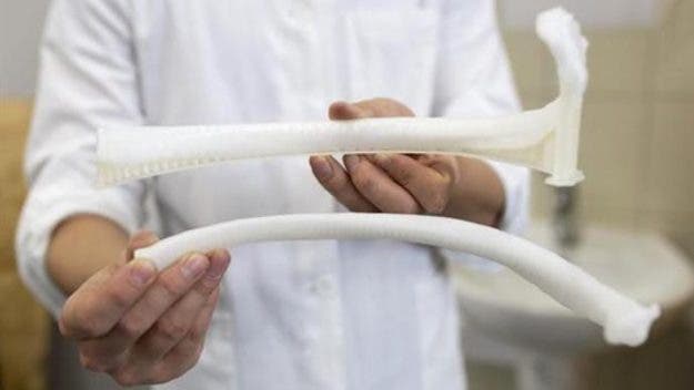 a doctor holds two 3d printed ribs